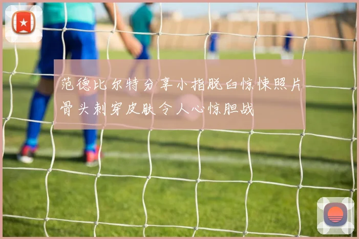 范德比尔特分享小指脱臼惊悚照片骨头刺穿皮肤令人心惊胆战